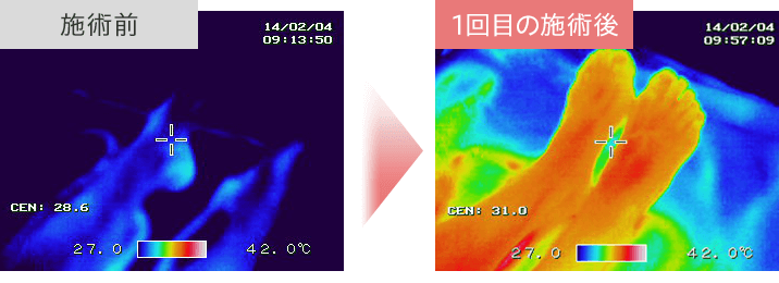 施術前→1回目の施術後