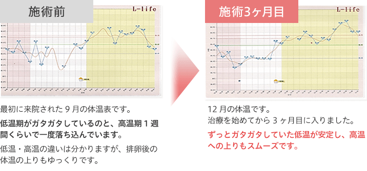 施術前→施術3ヶ月目